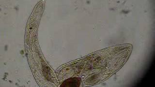 Gyratrix hermaphroditus Fam Polycystididae F Platyhelminthes 1 [upl. by Ttayh]