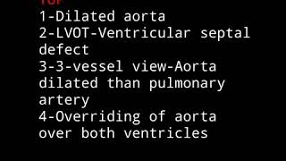 Fetal echocardiography Tetralogy of fallot TOF [upl. by Esmeralda]