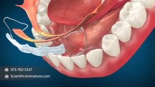 Orthodontic Procedures  Minor Tooth Movement [upl. by Germin150]