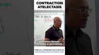 Contraction Atelectasis drnajeeb drnajeeblectures shortvideostatus [upl. by Drwde221]