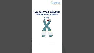 1p36 Deletion Syndrome [upl. by Xylina]