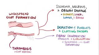 Disseminated intravascular coagulation causes symptoms diagnosis treatment pathology [upl. by Delanty761]