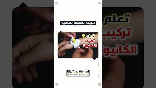 4 طرق لتثبت الكانيولا الطرفية [upl. by Eelsew]