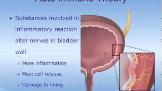 Understanding Interstitial Cystitis IC [upl. by Mckale300]