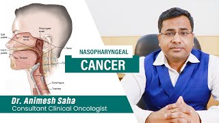 Nasopharyngeal cancer awareness  Best Oncologist in Kolkata  Cancer Specialist in Kolkata [upl. by Jordanson]