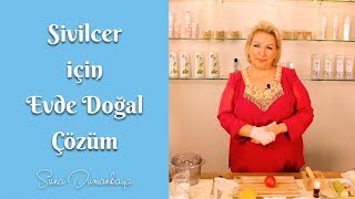 Suna Dumankaya  Sivilceler İçin Evde Doğal Çözüm  Güzellik amp Bakım [upl. by Oiramal]