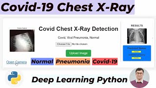 Building a COVID19 Detection System Using CNN Deep Learning  Flask CameraBased XRay App Hindi [upl. by Dric709]