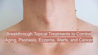 Topical Treatments for Psoriasis Eczema Warts and Aging health aging longevity inflammation [upl. by Eiggem]