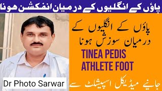 Tinea Pedis Or Athlete FooT Treatment  Dr Photo Sarwar Health Tips [upl. by Lleuqar128]