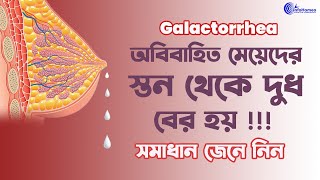 অবিবাহিত মেয়েদের বুকে দুধ আসার কারণ ও প্রতিকার  Nipple Discharge  Galactorrhea Treatment At Home [upl. by Adnam]