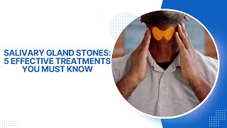 Salivary Gland Stones 5 Effective Treatments You Must Know [upl. by Htebazileharas471]