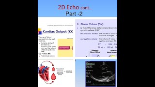 Basics of 2D Echo Part 2in Hindi  What is Ejection Fraction  What is EDV ESV SV and CO [upl. by Nahpos171]