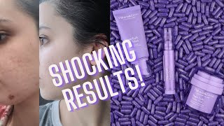 PILLOWTALK DERM REVIEW RESULTS AFTER 1 MONTH [upl. by Huckaby]