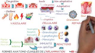 FORMES ANATOMO CLINIQUES DE L’INFLAMMATION  L’essentiel [upl. by Shah524]