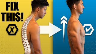 The Best Posture Workout At Home FIX YOUR HUNCHBACK [upl. by Ajin]