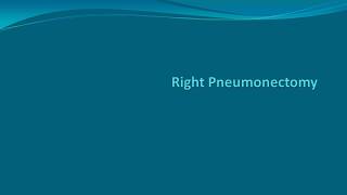 Right Pneumonectomy VATS and thoracotomy [upl. by Lleinnad]