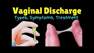 Vaginal Discharge  Is My Discharge Normal Thrush Bacterial Vaginosis STIFROM DR SIMI ADEDEJI [upl. by Ellenwahs729]