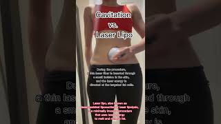 Cavitation vs Laser Lipo Explained  SculptSkin [upl. by Enaillil]