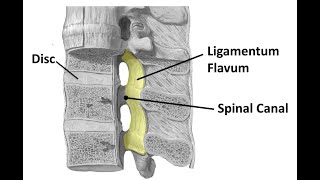 Anatomy of the Ligamentum Flavum [upl. by Adlev]