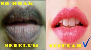 1 cara Memerahkan Bibir Hitam menjadi merah hasil permanen [upl. by Pauiie426]