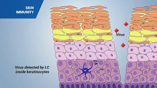 Immune response in the skin [upl. by Dream]