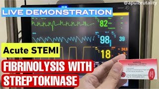 Fibrinolysis with streptokinase in acute STEMI  Cara fibrinolisis dengan streptokinase pada STEMI [upl. by Lora]