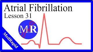 Atrial Fibrillation [upl. by Laram]