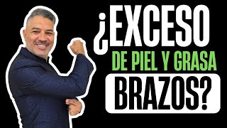 EXCESO DE PIEL GRASA amp FLACIDEZ EN LOS BRAZOS ¿En Qué Consiste ► ¡BRAQUIOPLASTIA SIN CICATRIZ [upl. by Artkele]