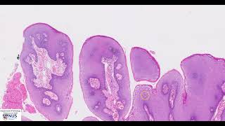 Condyloma Genital wart Microscopy  Talking slide [upl. by Oigroig]