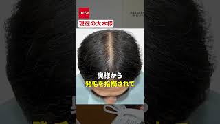 岡村社長に突撃！発毛日本一コンテスト出場者大木様について リーブ21 育毛 岡村社長 発毛 発毛塾 抜け毛 薄毛 髪の毛 発毛コンテスト [upl. by Menides]