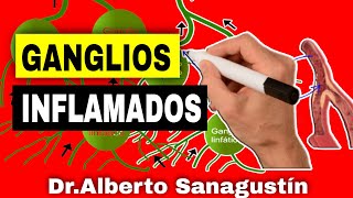 Signos PELIGROSOS en GANGLIOS LINFÁTICOS INFLAMADOS Adenopatías [upl. by Kolodgie]