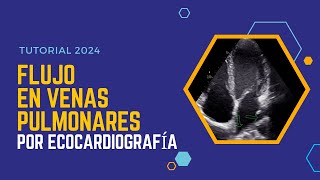 ✅FLUJO en VENAS PULMONARES por ECOCARDIOGRAFÍA 🔊Guía Completa con Doppler [upl. by Enilekaj]