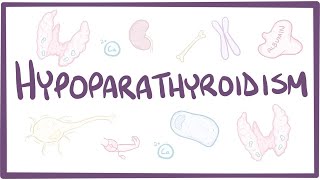 Hypoparathyroidism  causes symptoms diagnosis treatment pathology [upl. by Odrahcir]