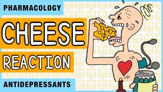 Cheese Reaction Pharmacology [upl. by Pillsbury]