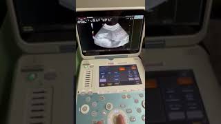 Esaote Ultrasound Demo Video [upl. by Kleinstein]