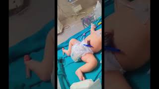 Newborn weighing 5kg big baby  macrosomia  youtubeshortspediatriciansnewbornbabies [upl. by Ellehcen]