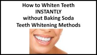 How to Whiten Teeth Instantly without Baking Soda  REAL Teeth Whitening Methods [upl. by Naraa]