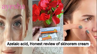 How to Use Azelaic Acid 20 benefits of azelaic acid Skinoren Cream Review in Pakistan [upl. by Perce895]