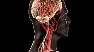 Temporal Arteritis [upl. by Gebhardt]