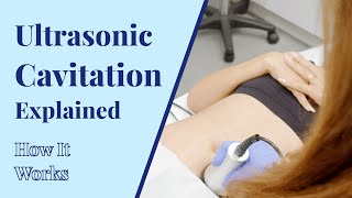 How Does Ultrasonic Cavitation Work  Body Treatments at BYou Laser Clinic in NYC [upl. by Ellehsram748]