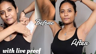 Home remedies to whiten your underarm in 1 ues with Live proof  topnotch beauty tips [upl. by Piotr179]