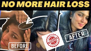 How To Avoid Hair Loss amp Improve Hair Growth  Tamil Weight Loss amp Hair Loss  Sakiye Sathya [upl. by Besse]