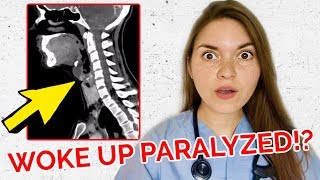 28 YEAR OLD PARALYZED IN HIS SLEEP Real Medical Case [upl. by Geof316]