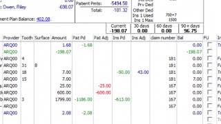 Ledger Did You Know  Dental Software Tips [upl. by Eitac]