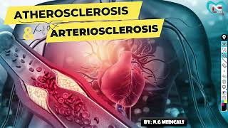 Arteriosclerosis and Atherosclerosis part 1 WITH EASY NOTES  EXPLANATION IN HINDI  NG MEDICALS [upl. by Ikkaj142]