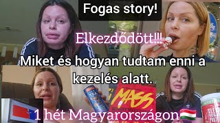 Fogászati kezelésem alatt miket és hogyan ettem 1hét Magyarországon Vlog [upl. by Coretta608]