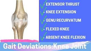 Gait Deviations Knee Joint Complex Secondary to Knee Joint Dysfunction [upl. by Enaffit85]