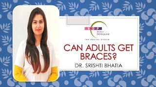 Can adults get braces  क्या वयस्कों को ब्रेसिज़ दिए जा सकते हैं  By Dr Srishti Bhatia [upl. by Mcmullan776]