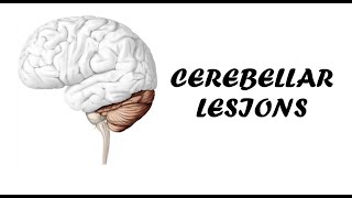 Cerebellar Lesions  Clinical Examination for Cerebellar Examination [upl. by Carolin]