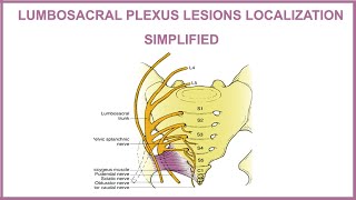 LUMBOSACRAL PLEXUS LESIONS LOCALIZATION SIMPLIFIED [upl. by Antoinetta]